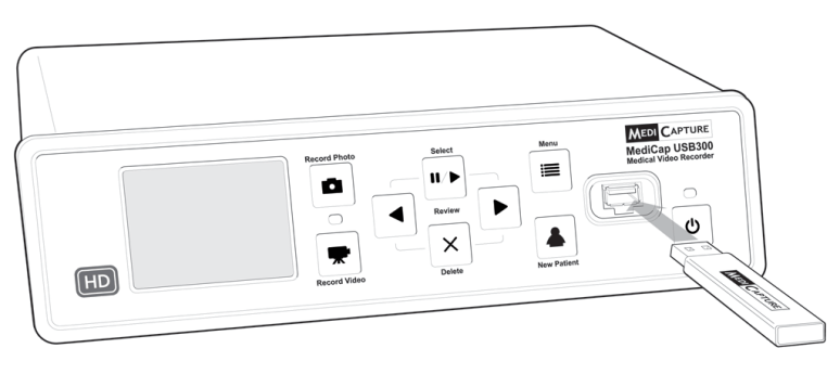 MediCapture_USB300_Front View